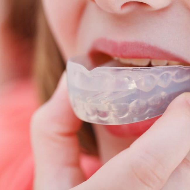 Girl Using Mouthguard — Denture Clinic in Bendigo, VIC