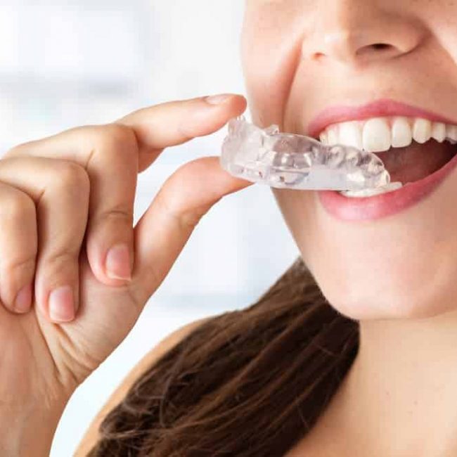 Woman Putting In Mouthguard — Denture Clinic in Bendigo, VIC