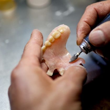 Denture Being Repaired — Denture Clinic in Bendigo, VIC