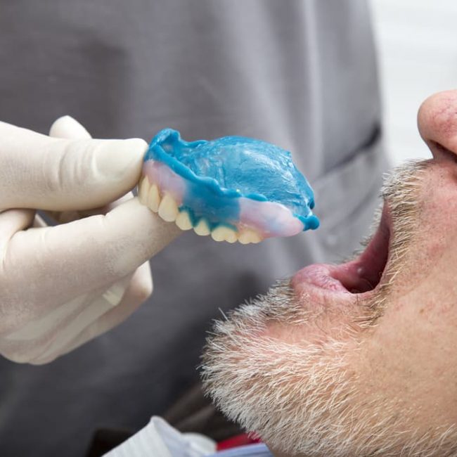 Dentist Fitting Denture — Denture Clinic in Bendigo, VIC