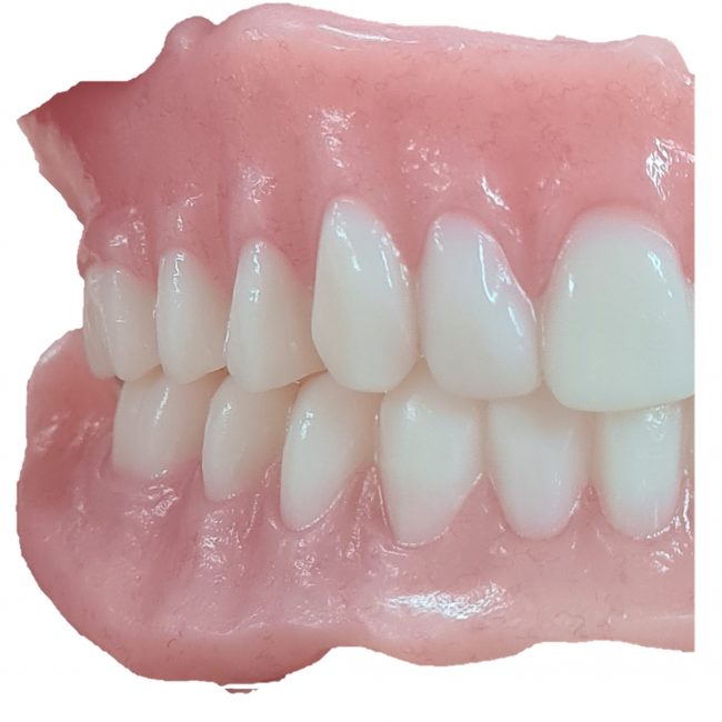 The benefits of digital dentures