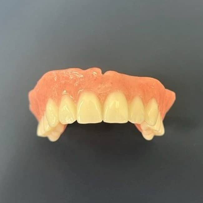 Close-up of Partial Denture — Denture Clinic in Bendigo, VIC